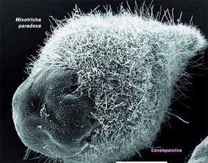 Mixotricha paradoxa (Bir bakteri değil, mikrobik bir tek hücreli hayvan)