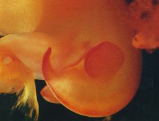 İnsan Embriyosu