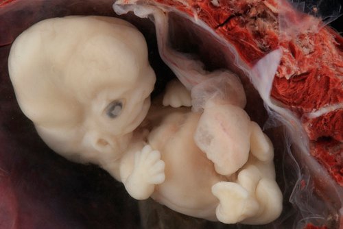İnsan Embriyosunda Parmaklar Arasında Perde