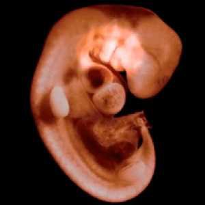 İnsan Embriyosunda Solungaç Yarıkları