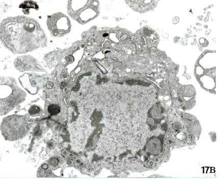 Hücre deformasyonuna bir örnek... Burada apoptosis olayı görülüyor olsa da, mekanik deformasyon bundan çok farklı değildir.