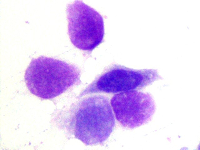 Bir çekirge hemolenfinde bulunan hemositler. Genelde bu hücreler Wright ya da Giemsa gibi boyalar aracılığıyla boyanırlar.