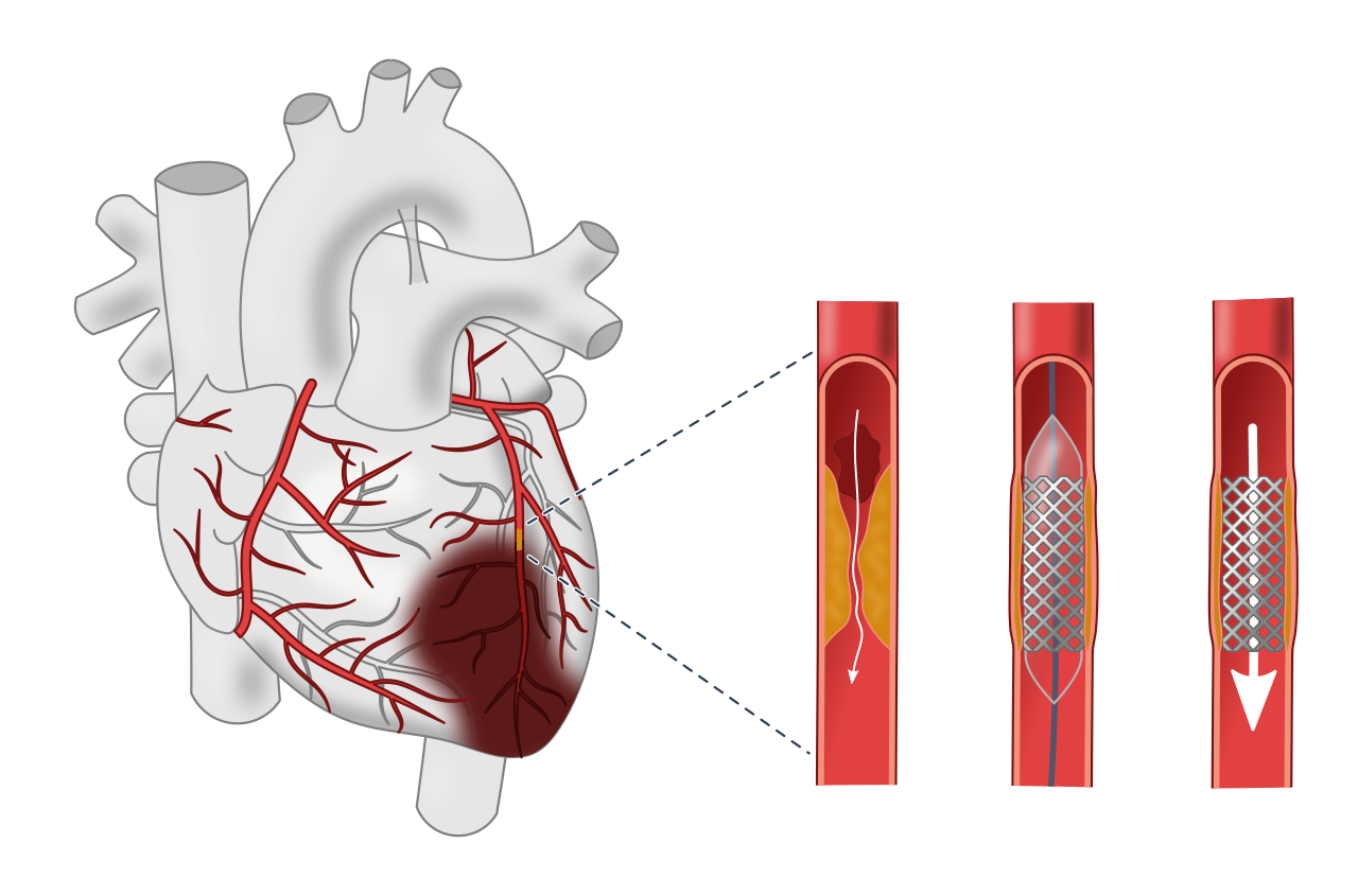 kalp sağlığı ipuçları pdf yazar