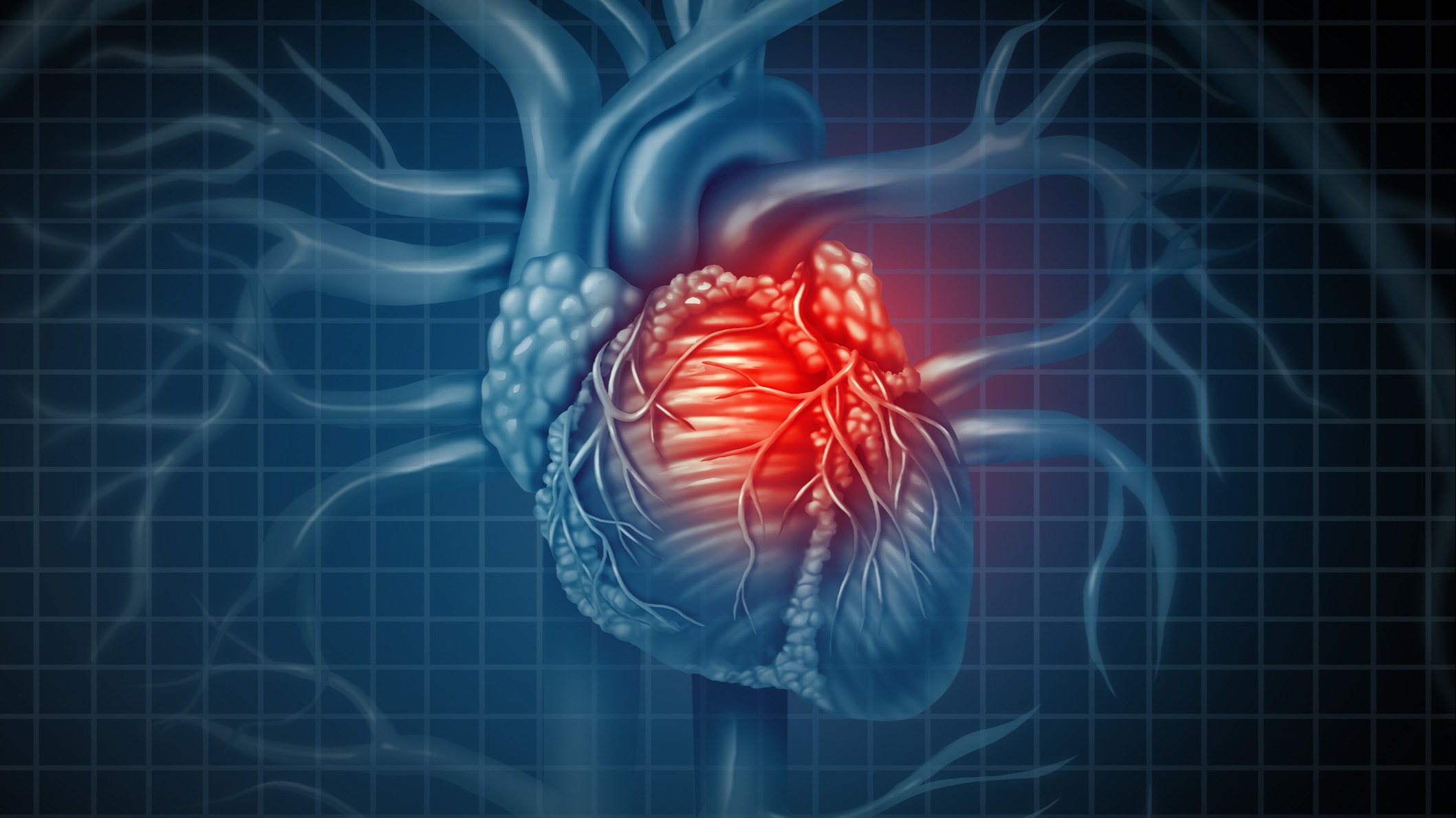 Kalp Krizi Nedir? Kalp Krizini Önlemek Mümkün mü? Kalp Krizi Geçirenlerin  Tedavisinde Kullanılan Yöntemler Nelerdir? - Evrim Ağacı
