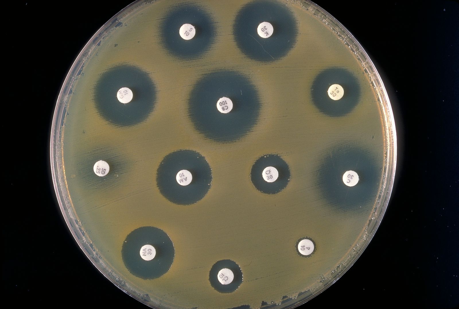 Bu bakteri kültüründe beyaz görünen diskler antibiyotik disklerdir. Bakteriler duyarlı oldukları antibiyotiklerin etrafında büyüyemiyorlar.